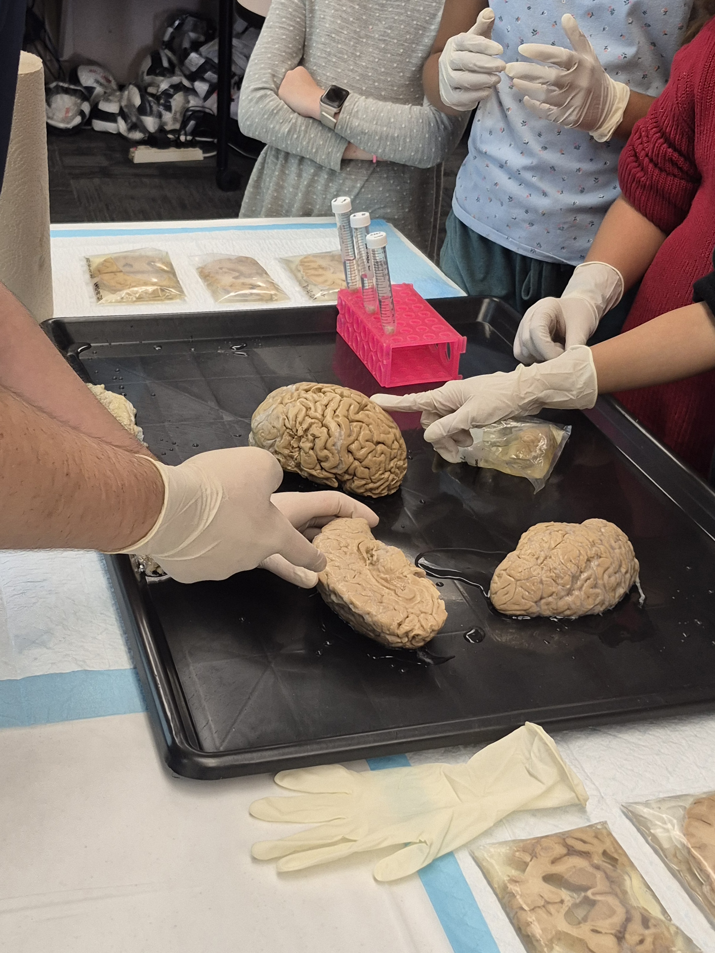 Brain samples with student pointing